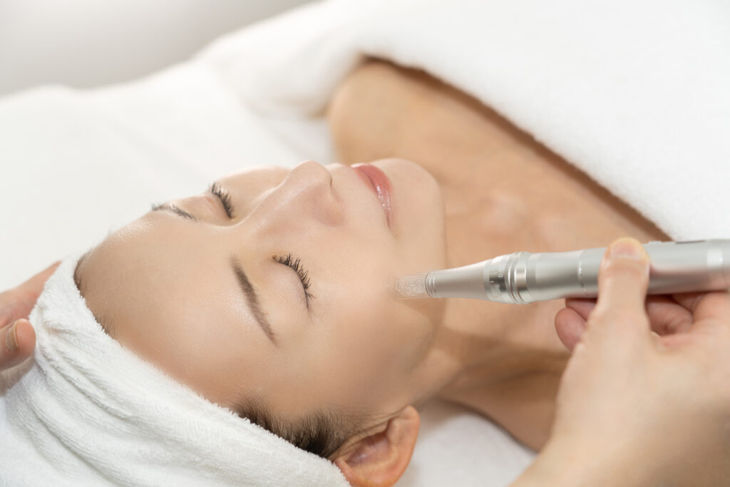 ソフトダーマペン